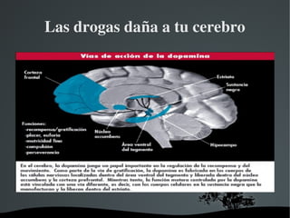   
Las drogas daña a tu cerebro
 