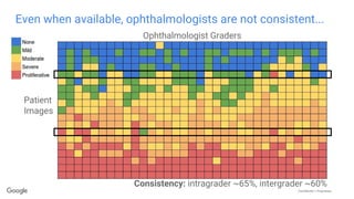 Confidential + Proprietary
Even when available, ophthalmologists are not consistent...
Consistency: intragrader ~65%, inte...