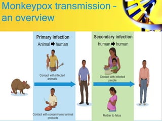 Monkeypox transmission –
an overview
 