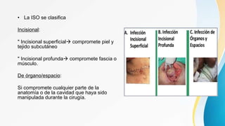 • La ISO se clasifica
Incisional:
" Incisional superficial compromete piel y
tejido subcutáneo
" Incisional profunda compromete fascia o
músculo.
De órgano/espacio:
Si compromete cualquier parte de la
anatomía o de la cavidad que haya sido
manipulada durante la cirugía.
 