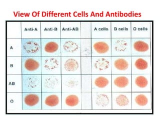 View Of Different Cells And Antibodies
 