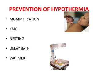 PREVENTION OF HYPOTHERMIA
• MUMMIFICATION
• KMC
• NESTING
• DELAY BATH
• WARMER
 