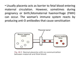 • Usually placenta acts as barrier to fetal blood entering
maternal circulation. However, sometimes during
pregnancy or birth,fetomaternal haemorrhage (FMH)
can occur. The woman’s immune system reacts by
producing anti-D antibodies that cause sensitisation
 