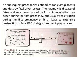 •In subsequent pregnancies antibodies can cross placenta
and destroy fetal erythrocytes. The haemolytic disease of
fetus and new born caused by Rh isoimmunisation can
occur during the first pregnancy, but usually sensitisation
during the first pregnancy or birth leads to extensive
destruction of fetal RBC during subsequent pregnancies
 