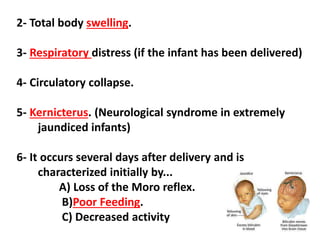 2- Total body swelling.
3- Respiratory distress (if the infant has been delivered)
4- Circulatory collapse.
5- Kernicterus. (Neurological syndrome in extremely
jaundiced infants)
6- It occurs several days after delivery and is
characterized initially by...
A) Loss of the Moro reflex.
B)Poor Feeding.
C) Decreased activity
 