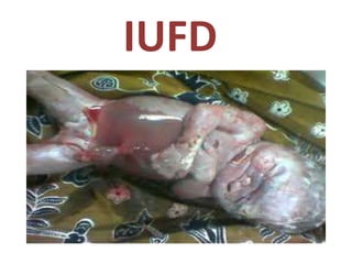 IUFD
 
