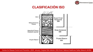 CLASIFICACIÓN ISO
Centers for Disease Control and Prevention. (2024, January). Surgical Site Infection (SSI) Event. National Healthcare Safety Network (NHSN)
 