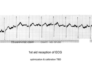 1st aid reception of ECG
optimization & calibration TBD
 