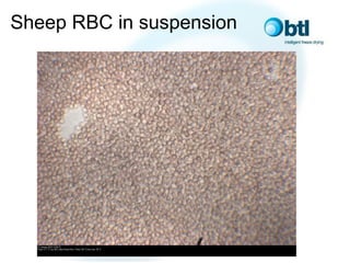 Sheep Rbc Lyophilization of Human Red Blood Cells | PDF