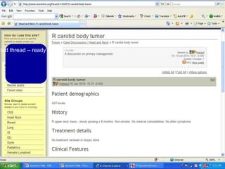 Here is the posted thread – ready for others to see. 