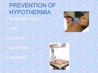 • MUMMIFICATION
• KMC
• NESTING
• DELAY BATH
• WARMER
 