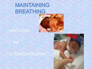 • VENTILATOR
• C PAP
• 02 SUPPLEMENTATION
 