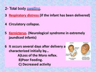 3 Respiratory distress (if the infant has been delivered)
4 Circulatory collapse.
5 Kernicterus. (Neurological syndrome in extremely
jaundiced infants)
6 It occurs several days after delivery and is
characterized initially by...
A)Loss of the Moro reflex.
B)Poor Feeding.
C) Decreased activity
 
