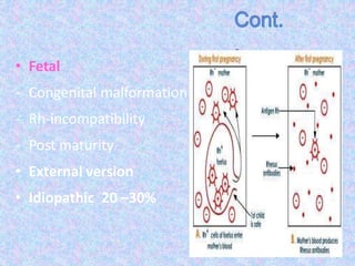 • Fetal
- Congenital malformation
- Rh-incompatibility
- Post maturity
• External version
• Idiopathic 20 –30%
 