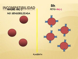 INCOMPATIBILIDAD
MADRE-Rh(-)
NO SENSIBILIZADA
Rh
FETO-Rh(+)
PLACENTA
 