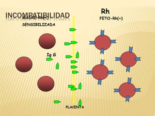 INCOMPATIBILIDAD
MADRE-Rh(-)
SENSIBILIZADA
Rh
FETO-Rh(+)
PLACENTA
Ig G
 