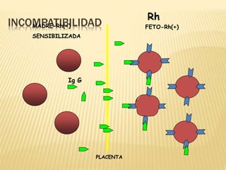 INCOMPATIBILIDAD
MADRE-Rh(-)
SENSIBILIZADA
Rh
FETO-Rh(+)
PLACENTA
Ig G
 