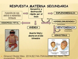 ANEMIA
HIDROPESIA FETAL
FIJACIÓN DE IGG
ANTI-D A HEMATÍES
FETALES
Secuestro y
destrucción
rápida por el
bazo
Muerte fetal y
aborto en el2do
trimestre
Hb Bilirrubina
HIPERBILIRRUBINEMIA
IctericiaSevera
KERNICTERUS
ESPLENOMEGALIA
HEPATOMEGALIA
Eritropoyesis
Compensatoria
 Ginecol Obstet Mex 2014;82:744-754Volumen 82, Núm. 11,
 