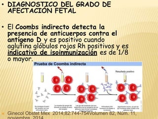 • DIAGNOSTICO DEL GRADO DE
AFECTACIÓN FETAL
• El Coombs indirecto detecta la
presencia de anticuerpos contra el
antígeno D y es positivo cuando
aglutina glóbulos rojos Rh positivos y es
indicativo de isoinmunización es de 1/8
o mayor.
 Ginecol Obstet Mex 2014;82:744-754Volumen 82, Núm. 11,
 