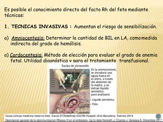 Es posible el conocimiento directo del facto Rh del feto mediante
técnicas:
1. TECNICAS INVASIVAS : Aumentan el riesgo de sensibilización.
a) Amniocentesis: Determinar la cantidad de BIL en LA, comomedida
indirecta del grado de hemólisis.
a) Cordocentesis: Método de elección para evaluar el grado de anemia
fetal. Utilidad diagnóstica y para el tratamiento transfusional.
 