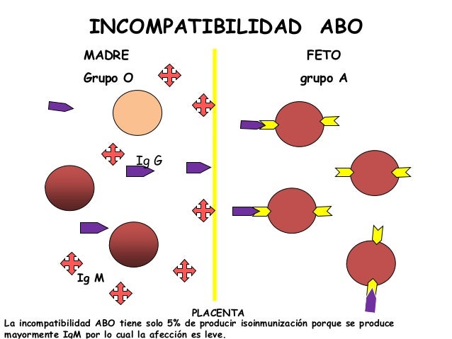 Resultado de imagen para isoinmunizaciÃ³n materno fetal