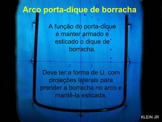 Arco porta-dique de borracha A função do porta-dique é manter armado e esticado o dique de borracha. Deve ter a forma de U, com projeções laterais para prender a borracha no arco e mantê-la esticada. KLEIN JR 