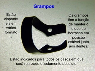 Grampos Os grampos têm a função de manter o dique de borracha em posição estável junto aos dentes. Estão indicados para todos os casos em que será realizado o isolamento absoluto. Estão disponíveis em vários formatos . KLEIN JR 