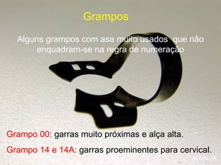 Grampo 00:   garras muito próximas e alça alta.   Grampo 14 e 14A:   garras proeminentes para cervical. Alguns grampos com asa muito usados  que não enquadram-se na regra de numeração Grampos KLEIN JR 