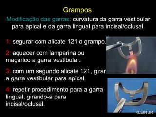 Grampos 1:  segurar com alicate 121 o grampo. 2:  aquecer com lamparina ou maçarico a garra vestibular. 3:  com um segundo alicate 121, girar a garra vestibular para apical. 4:  repetir procedimento para a garra lingual, girando-a para incisal/oclusal. Modificação das garras:  curvatura da garra vestibular para apical e da garra lingual para incisal/oclusal. KLEIN JR 