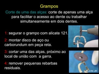 1:  segurar o grampo com alicate 121. 2:  montar disco de aço ou carborundum em peça reta. 3:  cortar uma das alças, próximo ao local de união com  a garra. 4:  remover pequenas rebarbas residuais. Grampos Corte de uma das alças:  corte de apenas uma alça para facilitar o acesso ao dente ou trabalhar simultaneamente em dois dentes. KLEIN JR 