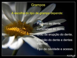Formato do dente. Dimensões do dente. Grau de erupção do dente. Posição do dente e dentes vizinhos. Tipo de cavidade e acesso. Grampos A escolha do tipo de grampo depende: KLEIN JR 