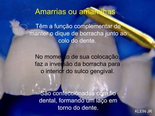 Amarrias ou amarrilhas  Têm a função complementar de manter o dique de borracha junto ao colo do dente.   No momento de sua colocação, faz a inversão da borracha para o interior do sulco gengival. São confeccionadas com fio dental, formando um laço em torno do dente. KLEIN JR 
