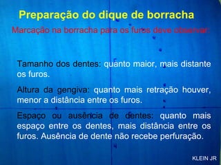 Marcação na borracha para os furos deve observar: Tamanho dos dentes:  quanto maior, mais distante os furos. Altura da gengiva:  quanto mais retração houver, menor a distância entre os furos. Espaço ou ausência de dentes:  quanto mais espaço entre os dentes, mais distância entre os furos. Ausência de dente não recebe perfuração. Preparação do dique de borracha KLEIN JR 