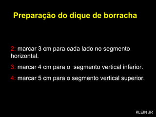2:  marcar 3 cm para cada lado no segmento horizontal. 3:  marcar 4 cm para o  segmento vertical inferior. 4:  marcar 5 cm para o segmento vertical superior. Preparação do dique de borracha KLEIN JR 