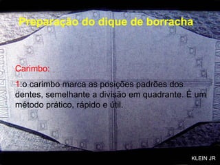 Carimbo: 1 :o carimbo marca as posições padrões dos dentes, semelhante a divisão em quadrante. É um método prático, rápido e útil. Preparação do dique de borracha KLEIN JR 