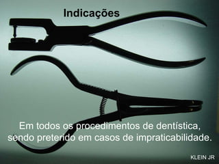 Indicações Em todos os procedimentos de dentística, sendo preterido em casos de impraticabilidade. KLEIN JR 