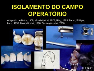 ISOLAMENTO DO CAMPO OPERATÓRIO Adaptado de Black, 1908; Mondelli et al, 1979; Ring, 1985; Baum, Phillips, Lund, 1996; Mondelli et al, 1998; Conceição et al, 2000 KLEIN JR 
