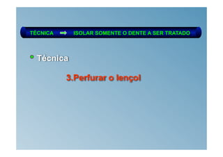 TÉCNICA     ISOLAR SOMENTE O DENTE A SER TRATADO



  Técnica

          3.Perfurar o lençol
 