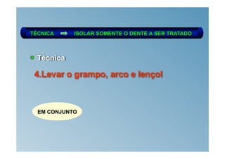 TÉCNICA     ISOLAR SOMENTE O DENTE A SER TRATADO



  Técnica

 4.Levar o grampo, arco e lençol



  EM CONJUNTO
 