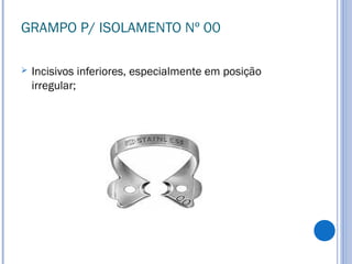 GRAMPO P/ ISOLAMENTO Nº 00
 Incisivos inferiores, especialmente em posição
irregular;
 