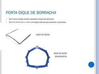 PORTA DIQUE DE BORRACHA
 Tem como função manter esticado o dique de borracha
 Deve ter forma de U, como projeções laterais para prender a borracha.
ARCO DE YOUNG
ARCO DE OSTBY
(ENDODONTIA)
 