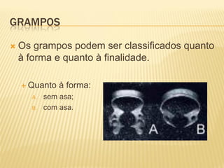 GRAMPOS

   Os grampos podem ser classificados quanto
    à forma e quanto à finalidade.

     Quanto   à forma:
      A.   sem asa;
      B.   com asa.
 