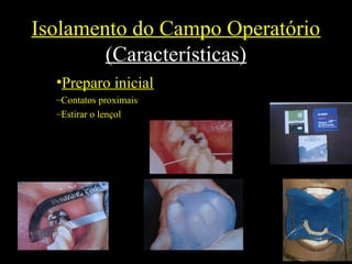 Isolamento do Campo Operatório
(Características)
•Preparo inicial
–Contatos proximais
–Estirar o lençol
 