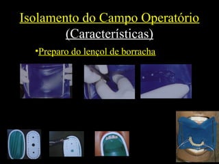 Isolamento do Campo Operatório
(Características)
•Preparo do lençol de borracha
 
