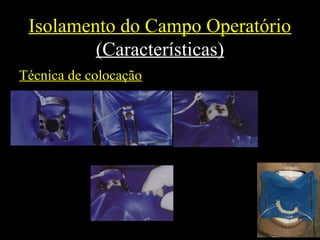 Isolamento do Campo Operatório
(Características)
Técnica de colocação
 