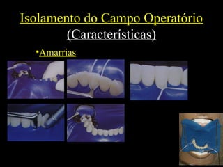 Isolamento do Campo Operatório
(Características)
•Amarrias
 