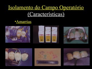Isolamento do Campo Operatório
(Características)
•Amarrias
 