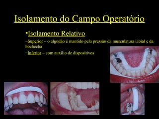 Isolamento do Campo Operatório
•Isolamento Relativo
–Superior – o algodão é mantido pela pressão da musculatura labial e da
bochecha
–Inferior – com auxílio de dispositivos
 