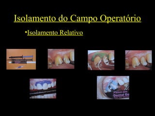 Isolamento do Campo Operatório
•Isolamento Relativo
 