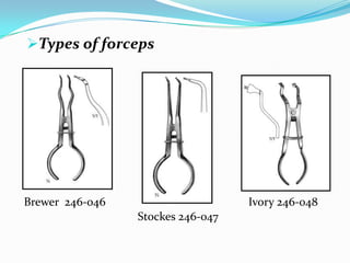 Types of forceps
Brewer 246-046
Stockes 246-047
Ivory 246-048
 